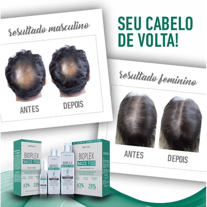 Shampoo para Queda de Cabelo